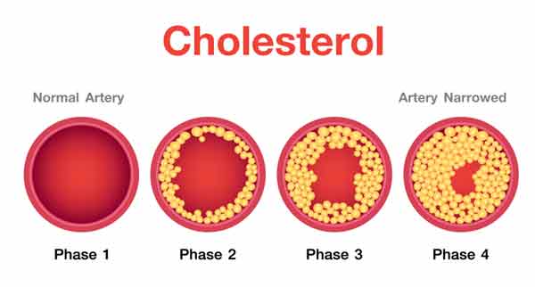 Control cholesterol levels